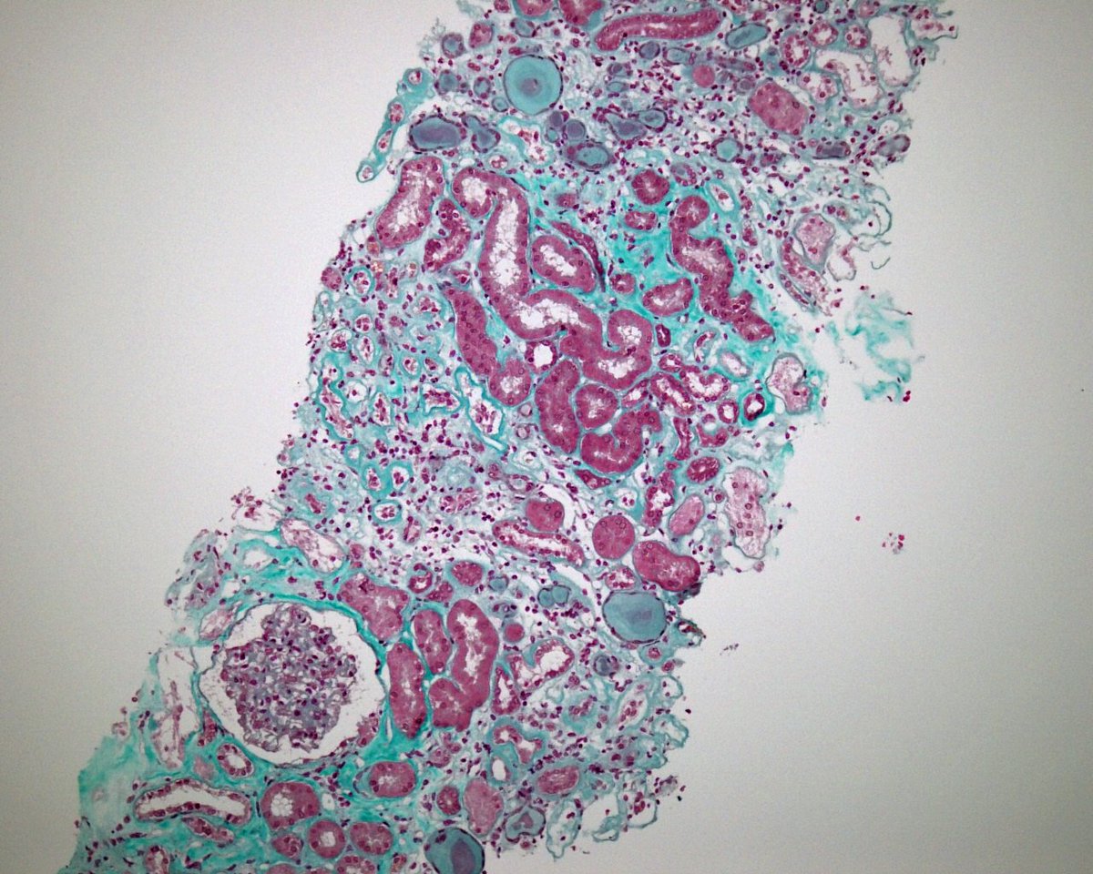 Bertrand Chauveau tweet media