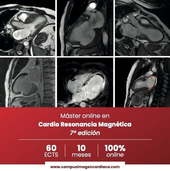 ¡7ª Edición! Máster en Cardio-RM ℹ️ Info - buff.ly/3ruEM0M ◀️ 📝 Registro - buff.ly/2GnBHdf ◀️ 📂 PDF - buff.ly/4awIBHf ◀️