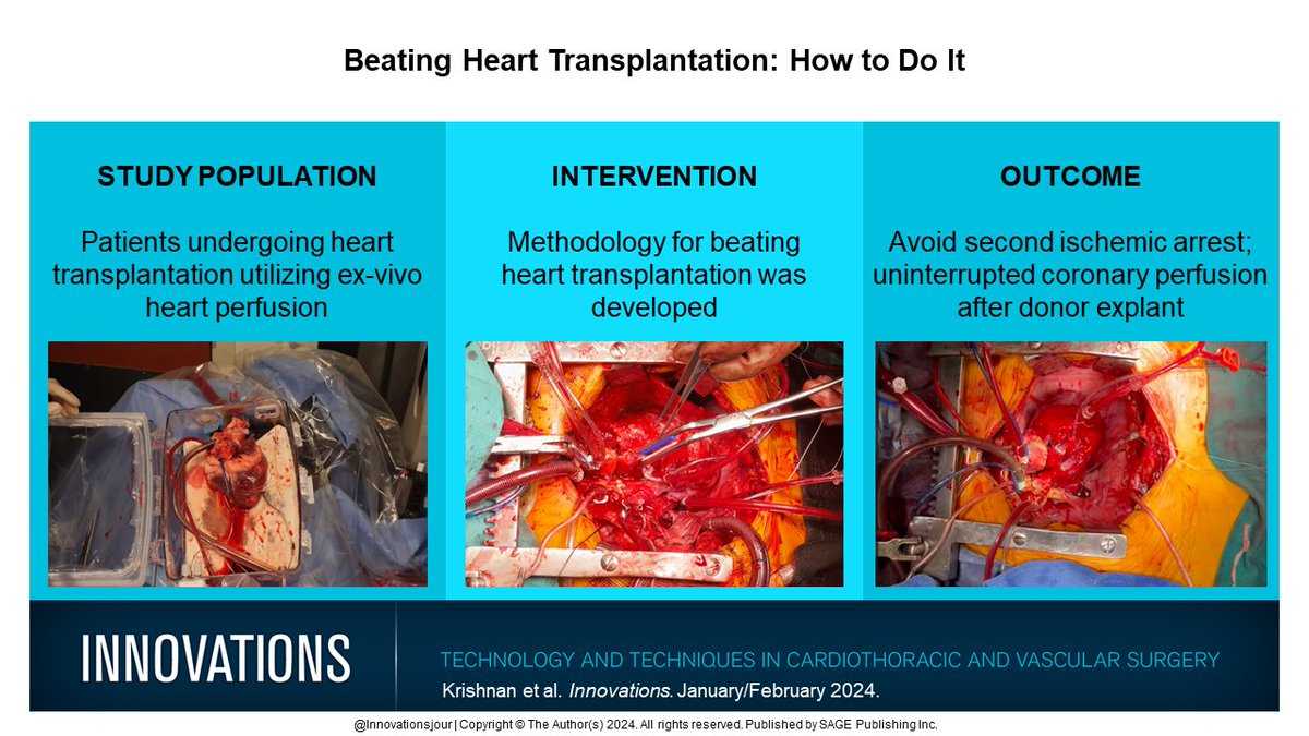 Drs @arav_krishnan @BAG_MD @elde_md @YuanjiaZhu @JW_MacArthur et al. provide a detailed discussion of how to perform a beating heart transplant Read free: journals.sagepub.com/share/SX9PARNB… #Cardiac #Transplantation #ExVivo #DCD @ChonyAlbertMD @JHMontfort10 @Dra_BelloIrene
