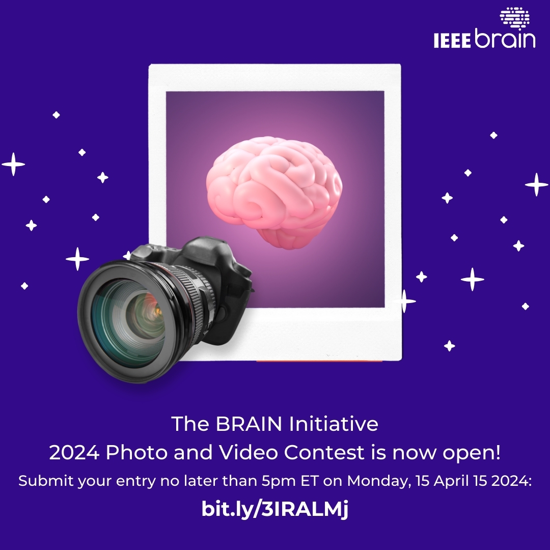 Reminder - the 2024 @NIH #BRAINInitiative Photo and Video Contest is now open for submissions, but only through 5pm ET on 15 Apr 2024. Hurry and get your creative, beautiful, and inspiring #neuroscience research images and short videos in: bit.ly/3IRALMj #NINDS #brain