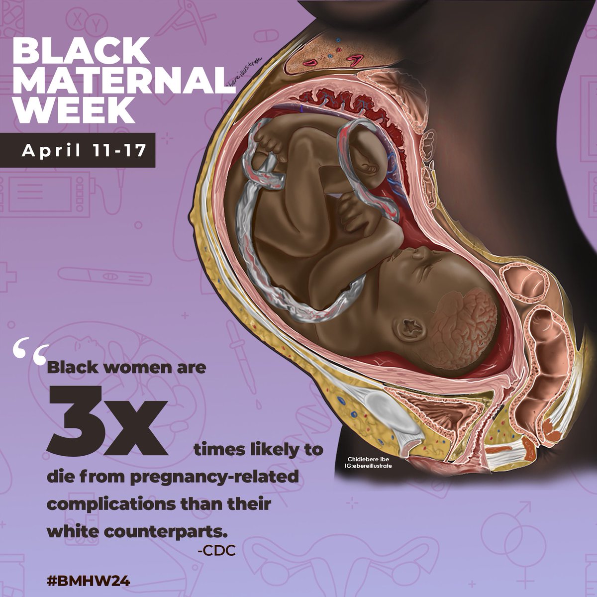 As we kick off Black Maternal Health Week, it is important to remember that Black women are 3x likely to die from pregnancy-related complications that are preventable, than their White counterparts.

We must advocate for equitable access to quality prenatal care,