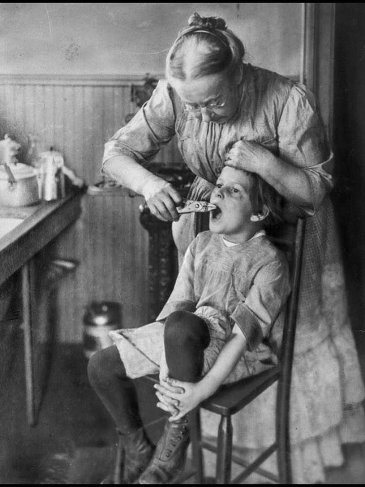 A woman prepares to pull a child’s tooth with a pliers, 1920s. amzn.to/4cPznHD