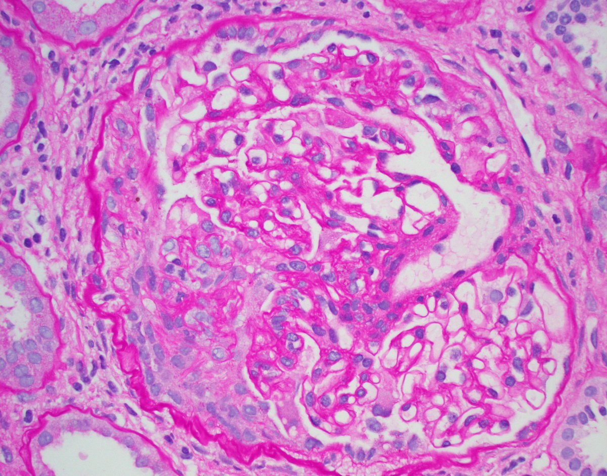 JZRenalPath tweet picture