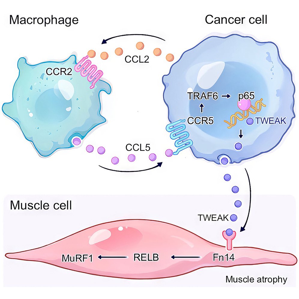 Online @Cancer_Cell The crosstalk between macrophages and cancer cells potentiates #PancreaticCancer cachexia By Min Li & colleagues @StephensonCC cell.com/cancer-cell/fu…