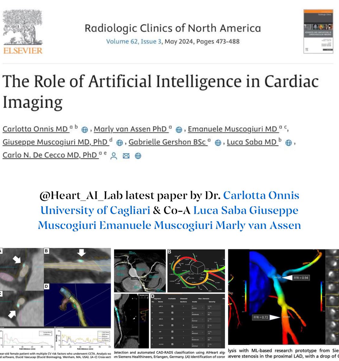 Do not miss the latest paper on #AI in cardiac imaging from the @Heart_AI_Lab @EmoryRadiology led by @CarlottaOnnis us.elsevierhealth.com/advances-and-i…