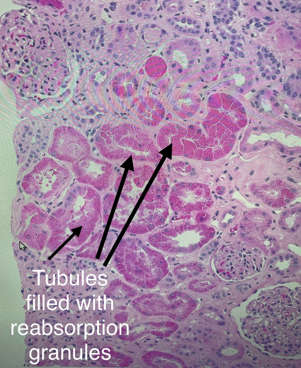 SethiRenalPath tweet picture