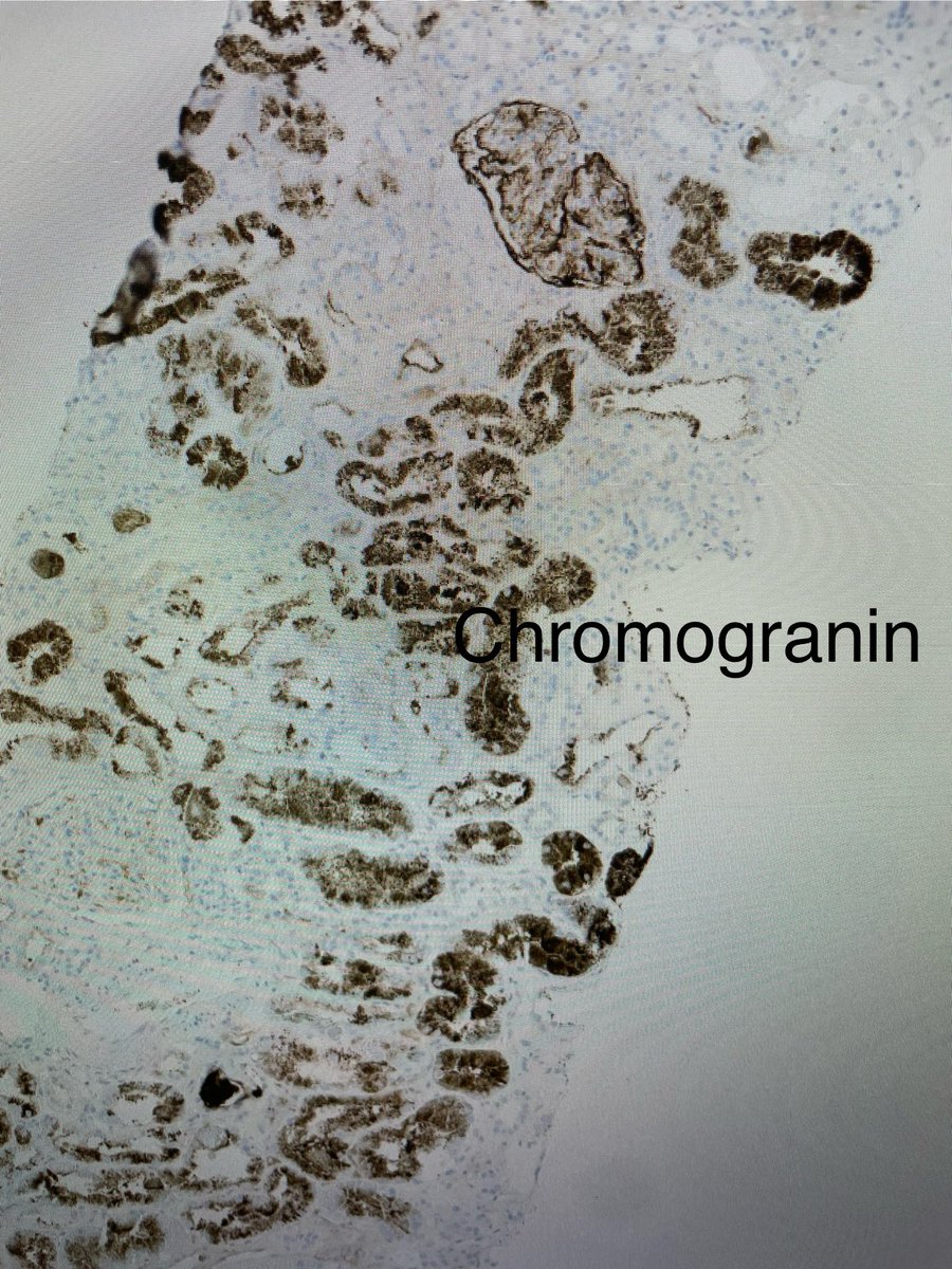 SethiRenalPath tweet picture