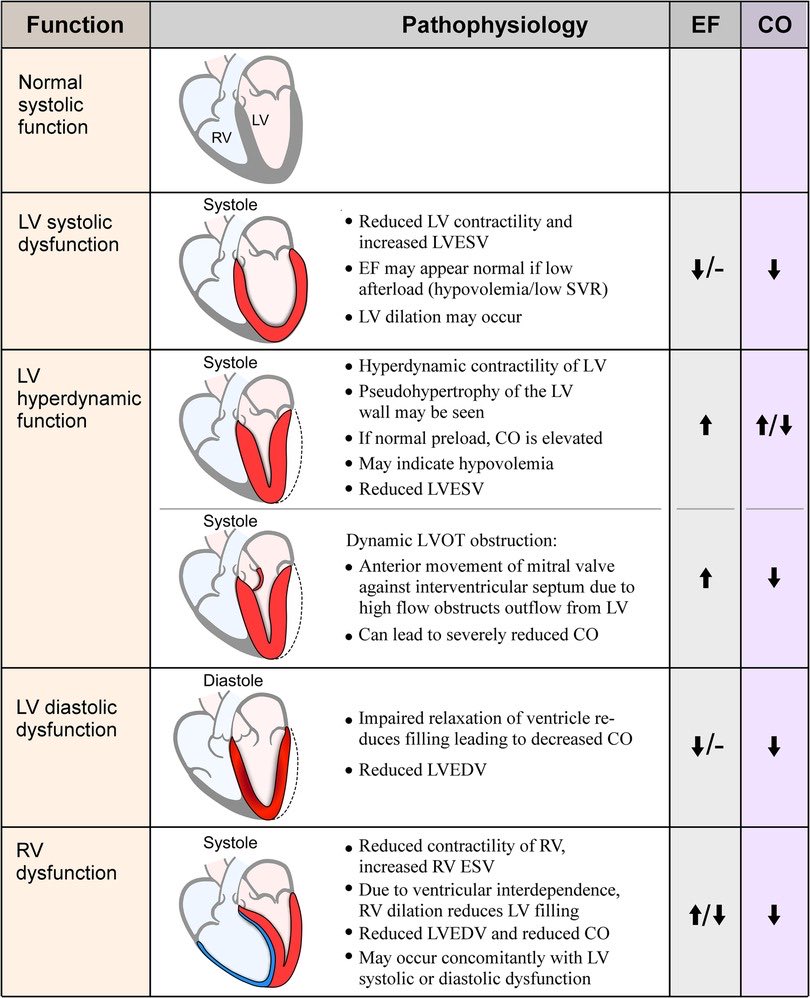 Sepsis-Induced myocardial dysfunction: heterogeneity of functional effects and clinical significance doi.org/10.3389/fcvm.2… #CardioEd #CardioTwitter #cardiotuiteros #MedEd