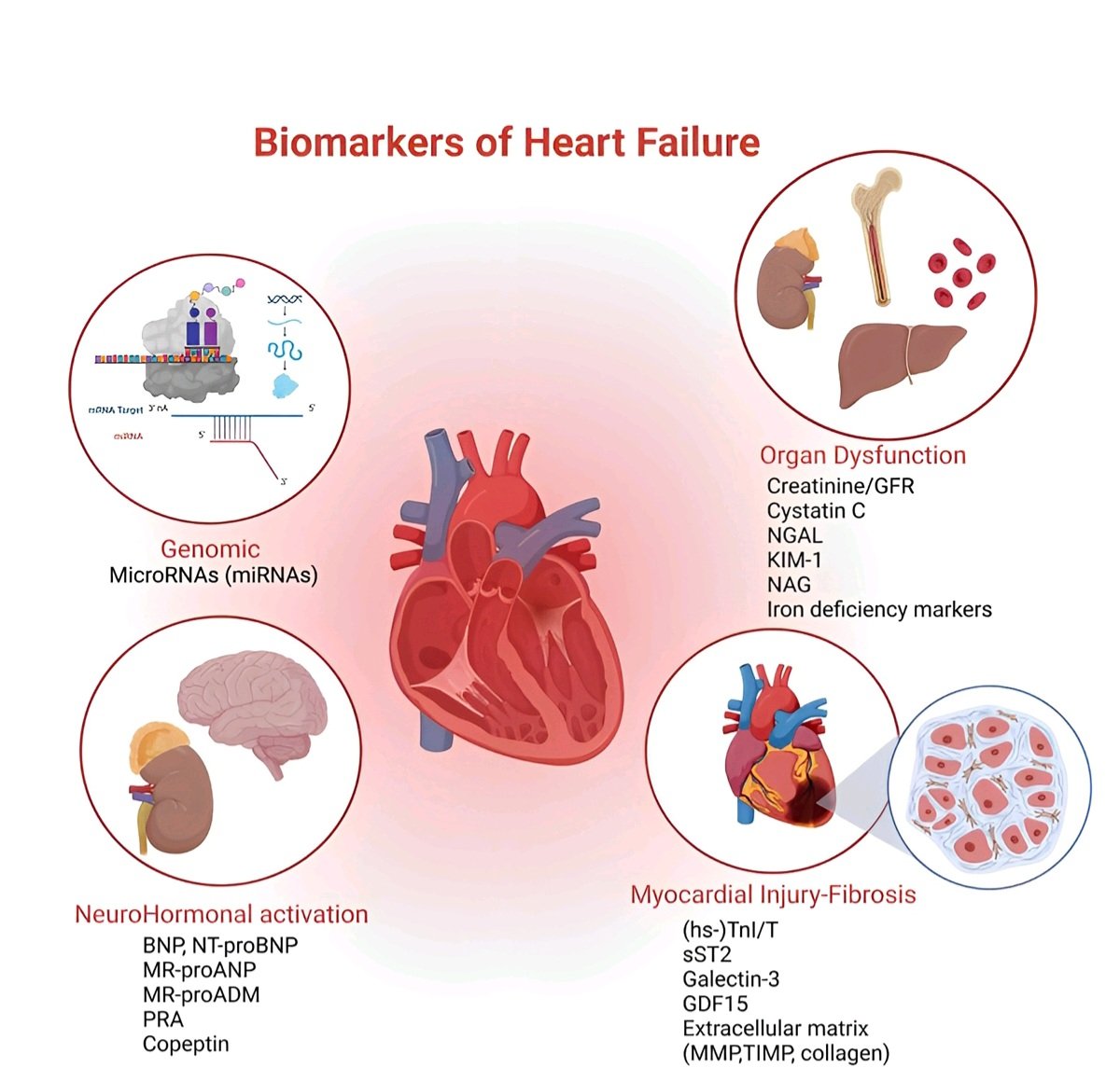 Biomarkers of Heart Failure : Revisited 🔬❤️ #cardiacpath doi.org/10.31083/j.rcm…