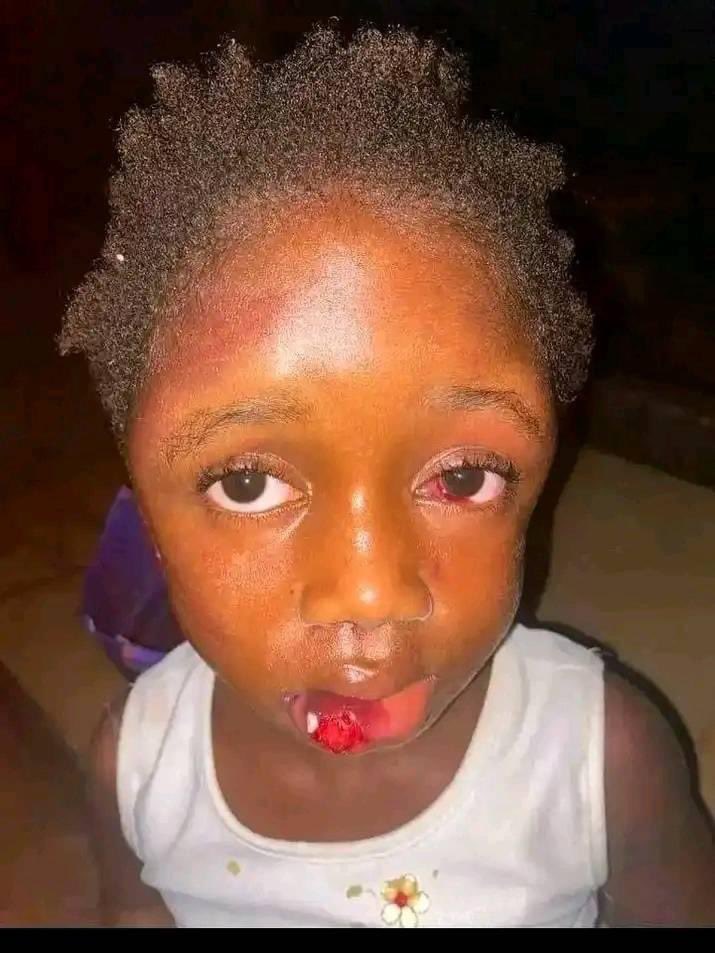 KimKimuntu's tweet photo. Une marâtre frappe violemment l'enfant de son mari, pour qu'elle puisse avouer sa sorcellerie , soit disant que c'est elle qui la bloque d'être stérile...

#famille https://t.co/uWBGe3tURr