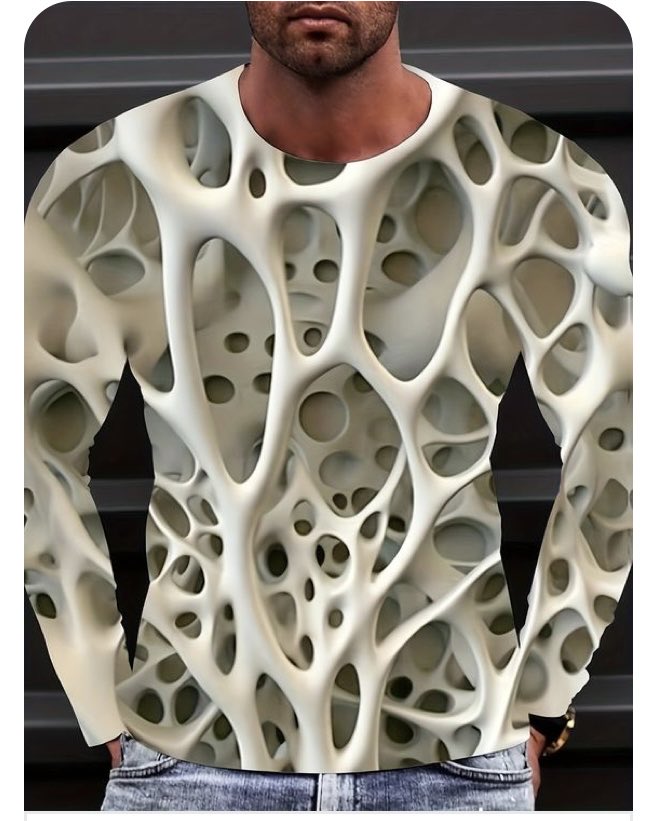 Osteoporosis. What do you see?