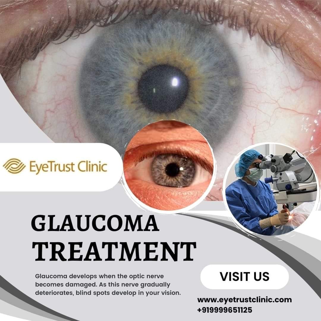 #Glaucoma 🏥 Eye Trust Clinic is here to provide you with expert Glaucoma treatment. Regain clarity and brightness in your world! 🌈
👩‍⚕️Book your consultation today!
Contact: (+91)-9999651125, (+91)-8377096565
Visit:eyetrustclinic.com
#GlaucomaTreatment #EyeTrustClinic