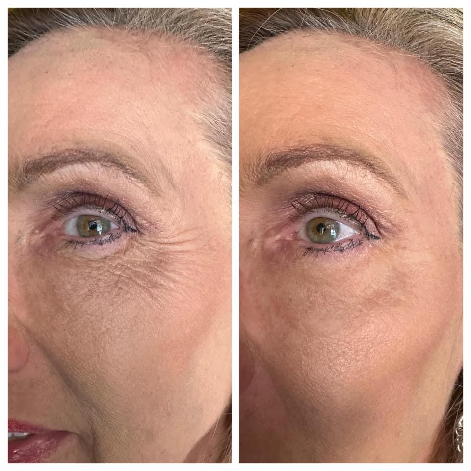 curry_carter's tweet photo. 🙋‍♀️Hey, just wanted to share that my friend Amber Johnson is loving her "glam on the go" look! 💁‍♀️ It's all about instant results with these amazing high-performing products! Do have have wrinkles around your eyes?
Age IQ is the solution. I have a $10 off coupon😉 https://t.co/gEy8TLDkHt