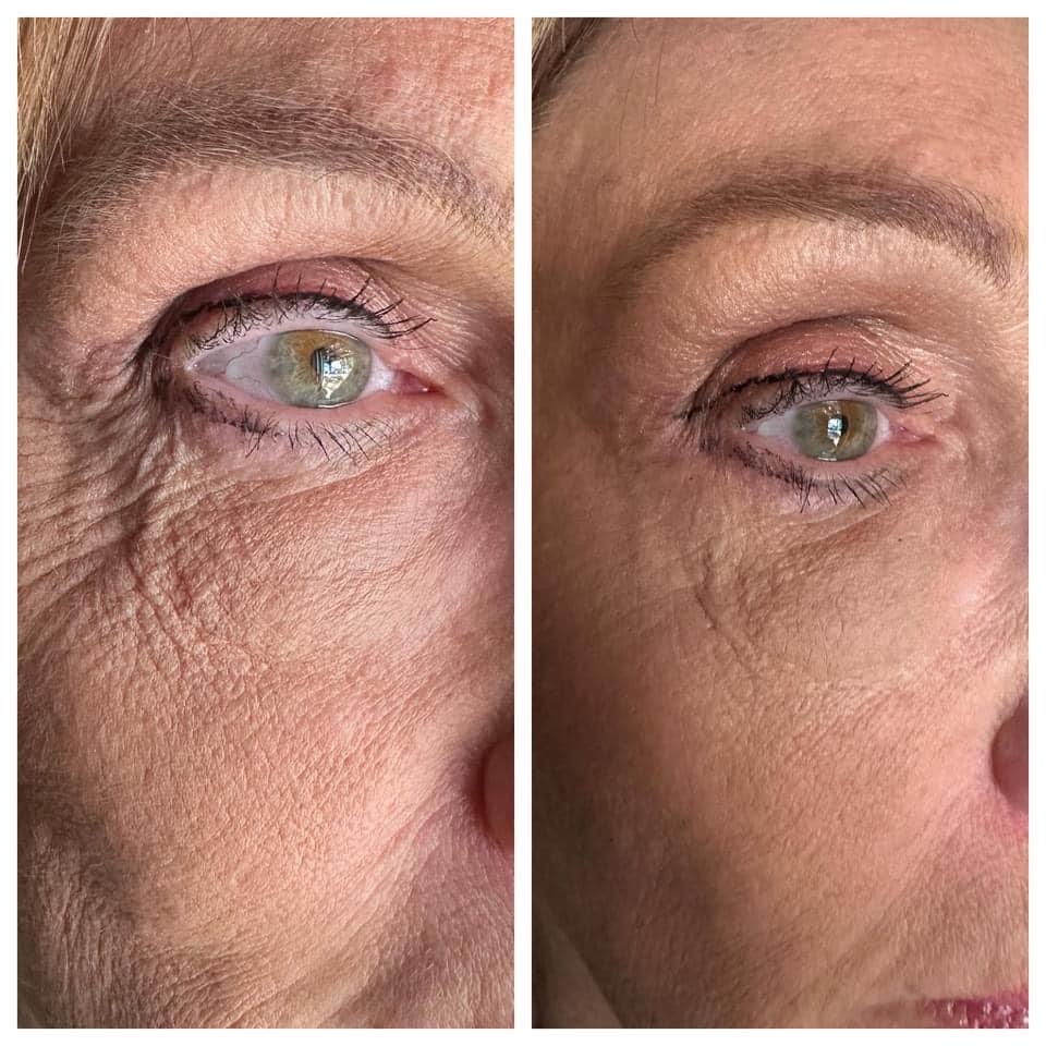curry_carter's tweet photo. 🙋‍♀️Hey, just wanted to share that my friend Amber Johnson is loving her "glam on the go" look! 💁‍♀️ It's all about instant results with these amazing high-performing products! Do have have wrinkles around your eyes?
Age IQ is the solution. I have a $10 off coupon😉 https://t.co/gEy8TLDkHt