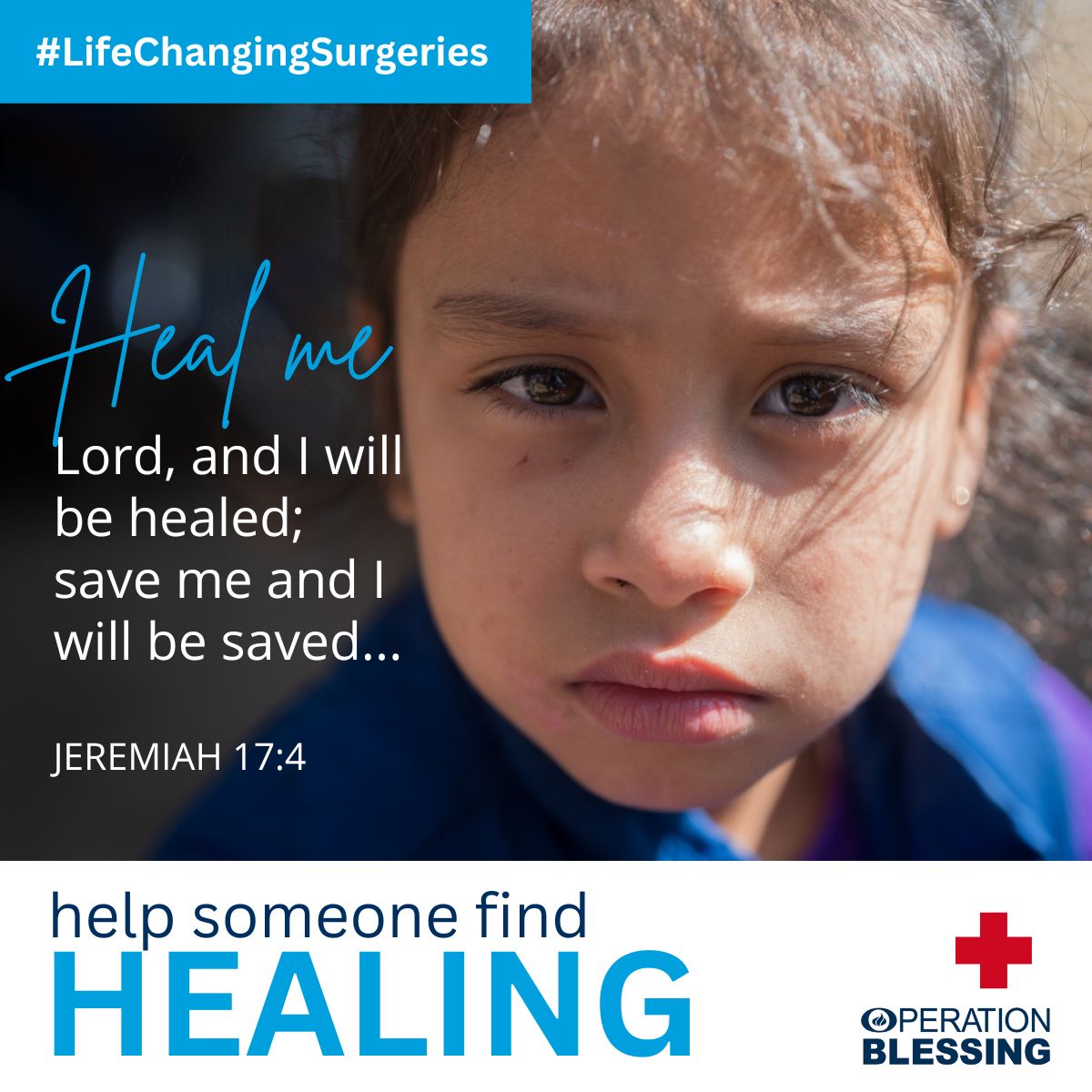 Can you put a price on healing? Health is a precious gift—especially for those without access to medical care. But you can give the gift of healing through a #LifeChangingSurgery all year long when you join our LCS family. Give someone hope today: ob.org/lcsfamily #OBI