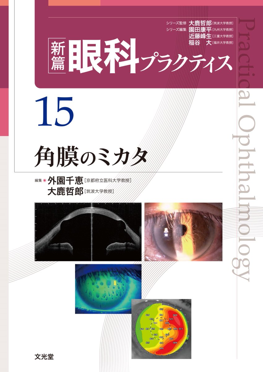 天ブックス: 眼病理アトラス - 大鹿哲郎 - 9784883786886 : 本 - 本