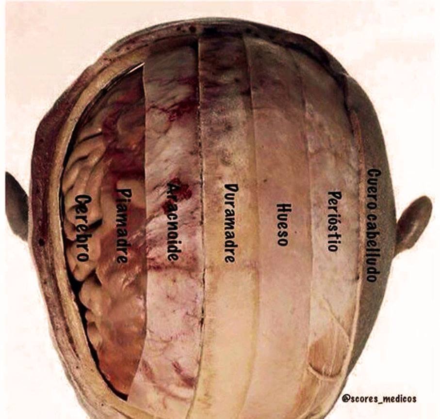 Capas de la bóveda craneal 🧠