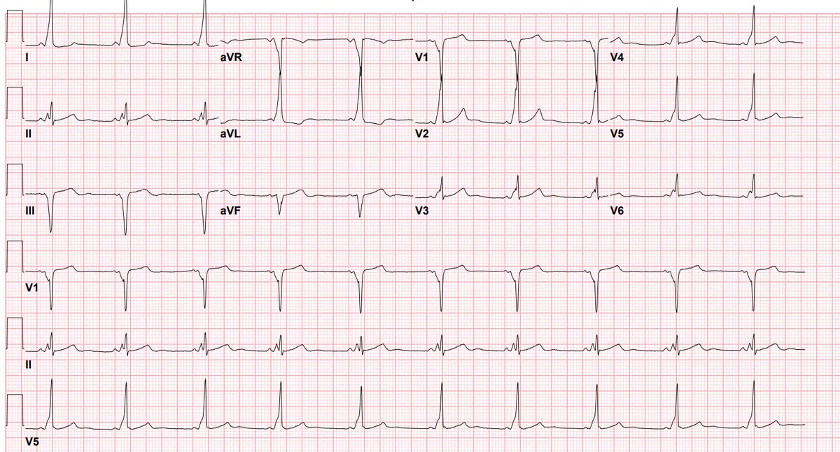 Chi Zhang, MD tweet media