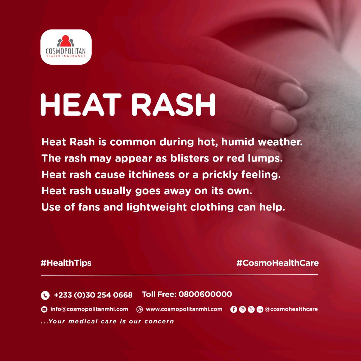 It's FRIDAY! 

Today, we continue on our #HealthTips.

What is HEAT RASH? 

Share your thoughts with us in the comments.

Stay healthy, Stay Safe and Stay Insured!

#CosmoHealthCare
#TGIF