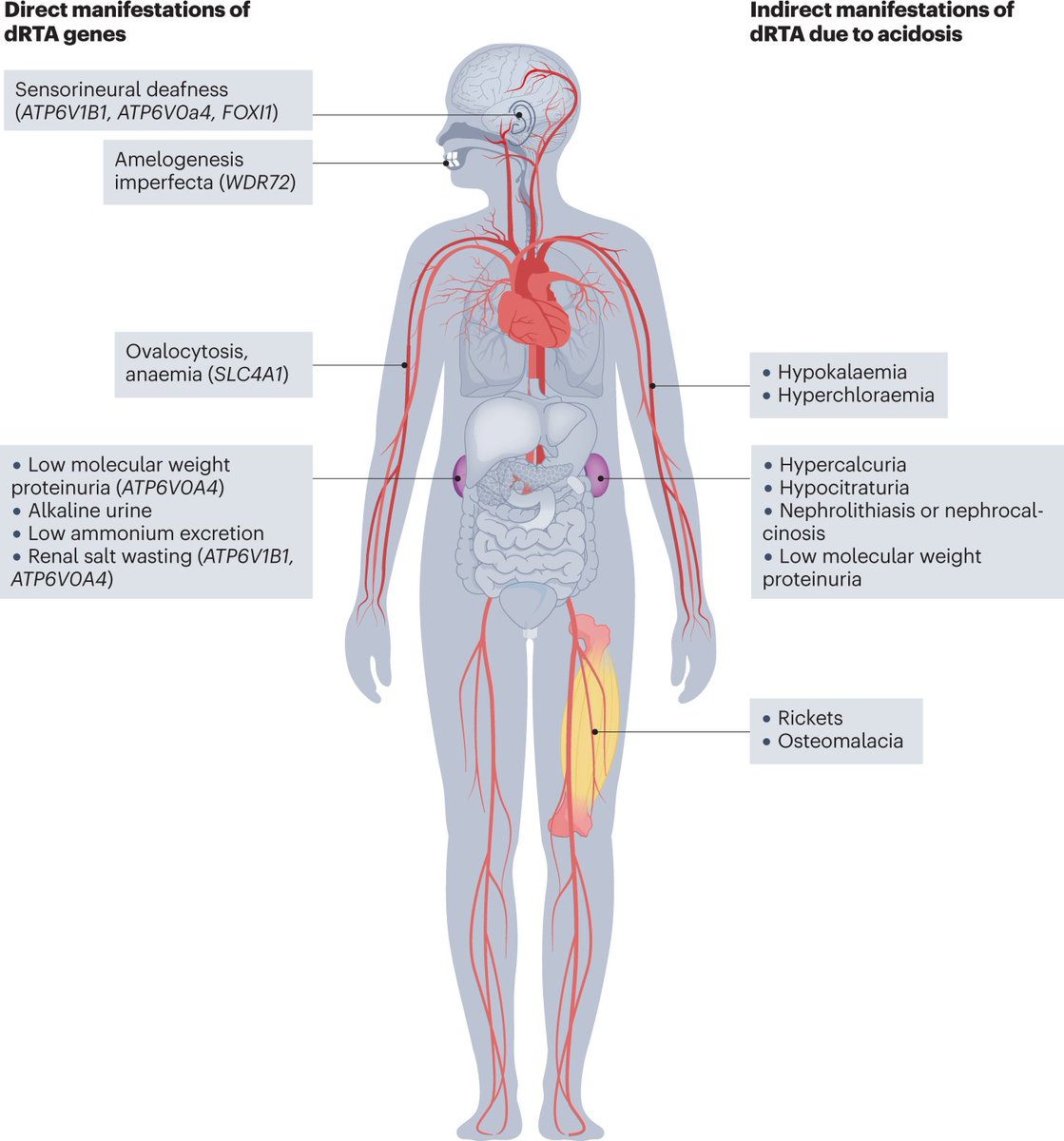 Spectrum of clinical features associated with distal renal tubular acidosis go.nature.com/3Er3xRC