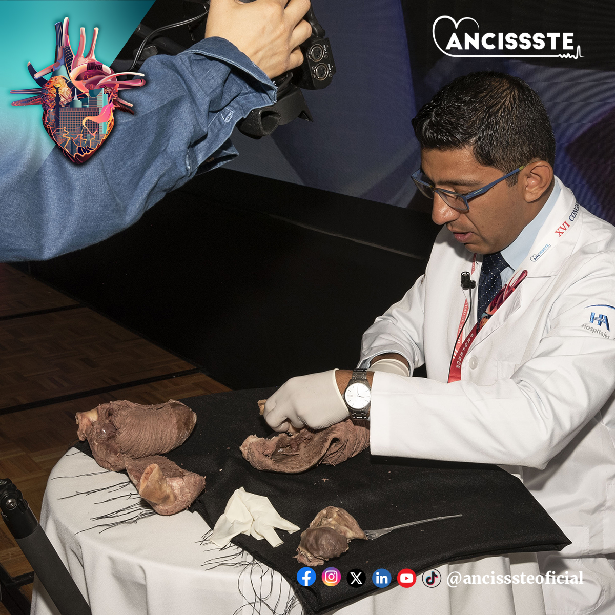 ANCISSSTE Oficial (@ancissstemx) on Twitter photo Talleres de #Ecocardiografía y #PuncionesGuiadas por ultrasonido. #Ultrasonido #TallerMédico #xviancissste #Cardiología #InnovaciónMédica #CICANCISSSTE2024 #CongresoCardiología #XVICongresoCardiología #worldtradecentercdmx #ANCISSSTE <a href="/AncisssteMx/">ANCISSSTE Oficial</a> Talleres de #Ecocardiografía y #PuncionesGuiadas por ultrasonido. #Ultrasonido #TallerMédico #xviancissste #Cardiología #InnovaciónMédica #CICANCISSSTE2024 #CongresoCardiología #XVICongresoCardiología #worldtradecentercdmx #ANCISSSTE <a href="/AncisssteMx/">ANCISSSTE Oficial</a>