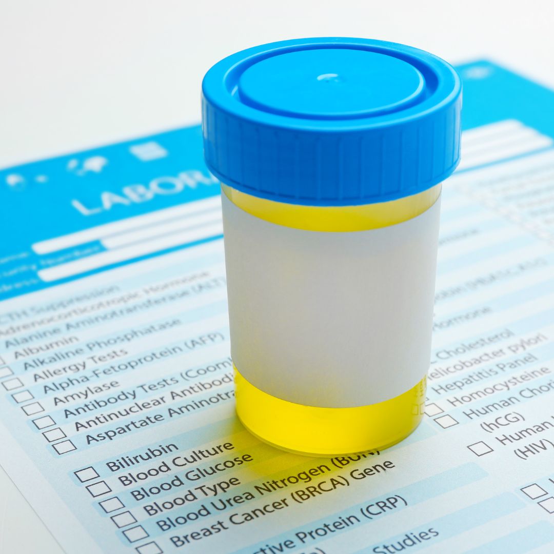 Many women are unsure how to take a urine sample when they have a suspected urinary tract infection. 

Better information could improve treatment: 

evidence.nihr.ac.uk/alert/do-women…

#uti #womenshealth #urinarytractinfection