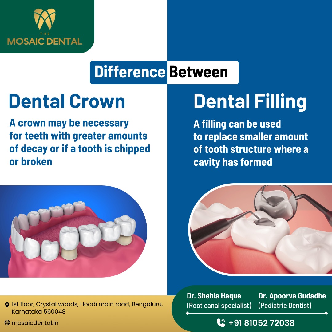 Do you know the difference between a #DentalCrown and a #DentalFilling❔ Let's discover here.
themosaicdental.in

#TheMosaicDental #MosaicDental #AskTheDentist #DentalProcedures #CrownsVsFillings #DentalCrown #DentalFilling #SmileMakeover #InstaDentist #Bangalore #Karnataka