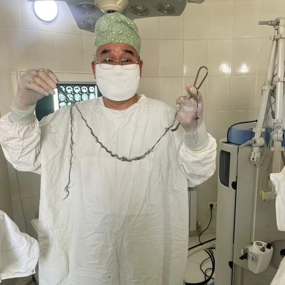 Kırgızistan’da hastaneye başvuran 8 yaşındaki kız çocuğunun beyninden bir tutam saç çıktı.