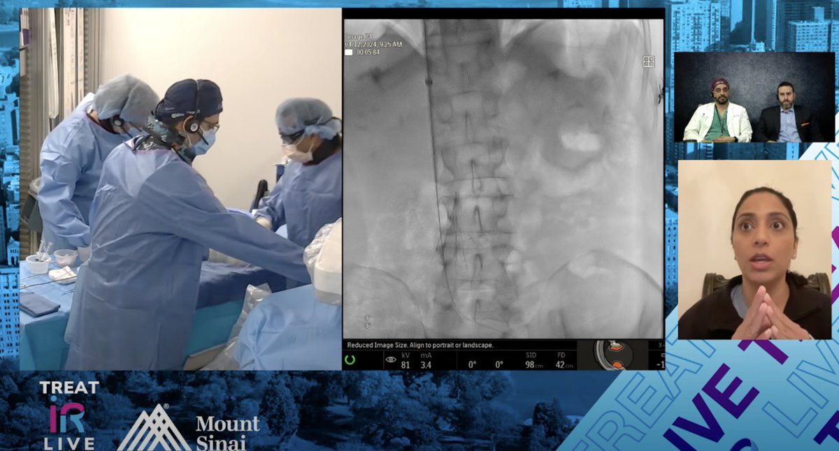 LIVE @MountSinaiIR #TREATLive #FILTEROUT case underway featuring Dr. Patel, Dr. Nowakowski, and Dr. Rana @PuneetR2018. @RSP516 @DanShilo @msran124 moderating and providing key insights @_backtable #IRad treatsymposium.com