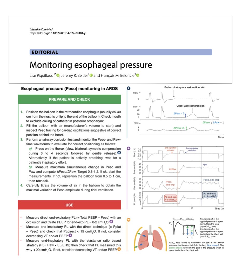 Monitoring esophageal pressure may help 🫁 setting PEEP & monitoring for occult excessive lung stress, (safely) exceeding conventional limits on PEEP/plateau pressure in selected patients 🫁 assessing pt-ventilator synchrony + respiratory effort #FOAMcc 🔓 rdcu.be/dEyZ0
