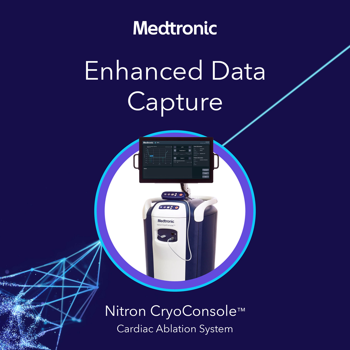 The new Nitron CryoConsole™ system offers enhanced data capture: Automated & customizable key procedural data captures real-time and post-procedure in exportable case summary reports. Learn more: bit.ly/3Uf8rtE See risk/benefit info: bit.ly/3Ug8PZ5