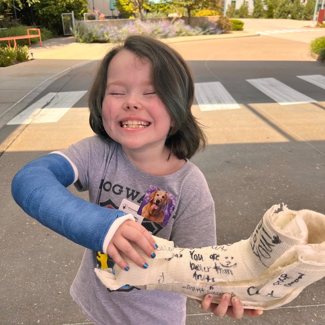 Did you know we offer a Same-Day Fracture Clinic? Our facility offers prompt care for children with non-emergent fractures (Monday through Friday). Keep our Fracture Clinic number handy: 314-964-8191 #Kids #Hope #FractureClinic #Orthopedics #Healing @shrinershosp