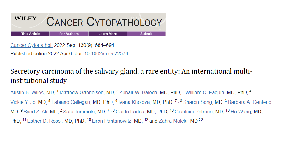 Secretory carcinoma (parotid gland): ▫️Oncocytic/vacuolated cells ▫️Bland nuclei w binucleation ▫️Transgressing vessels Thanks for the useful paper, @ZMaleki_cyto @aakasharmand @bfaquin @sza_jhcyto @PathPro @DianaEstherossi @IvanaKholova et al. #FNAFriday #CytoPath #MilanSystem