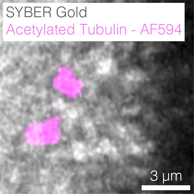 Quantitative Imaging tweet media