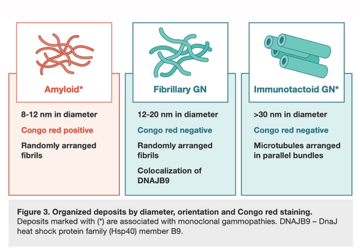 🫘🦀Spectrum of renal involvement in Monoclonal gammopathy of renal significance (MGRS)

<a href="/KIReports/">KIReports</a> 

kireportscommunity.org/post/monoclona…

👏 Nice review <a href="/Tiff_Caza/">Tiffany Caza</a> <a href="/SaiAchi1/">Sai Achi, MD</a> <a href="/CTeodosiu/">Corina Teodosiu 🕊️ 🇺🇦</a>
