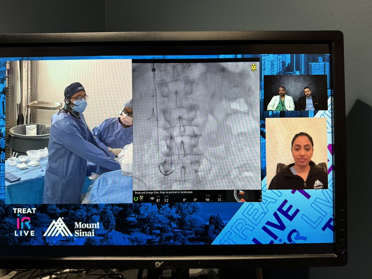 #TREATLIVE is this month with a case of #filterout @MountSinaiIR @_backtable #filteroutfriday @msran124 @RSP516 @DanShilo @uclaVIR