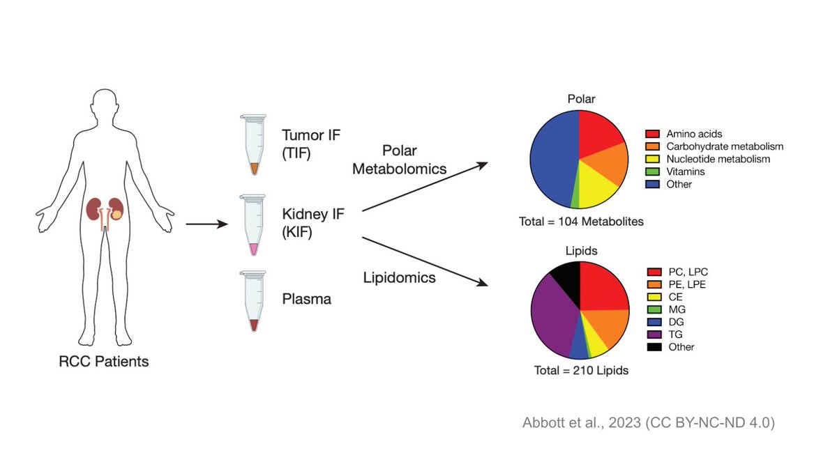 The local abundance of metabolites impacts the biology of the tumour microenvironment, new study of kidney tumours finds. #ReviewedPreprint with public reviews by @eLife. sciety.org/articles/activ…