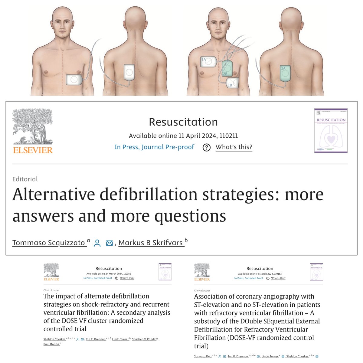 Additional evidence is emerging from the DOSE-VF trial ⚡️ In this editorial, @MarkusSkrifvars and I discuss two sub-studies from the #DOSEVF trial investigators, exploring the impact of: 1) CAG/PCI sciencedirect.com/science/articl… 2) Refractory vs recurrent VF sciencedirect.com/science/articl…