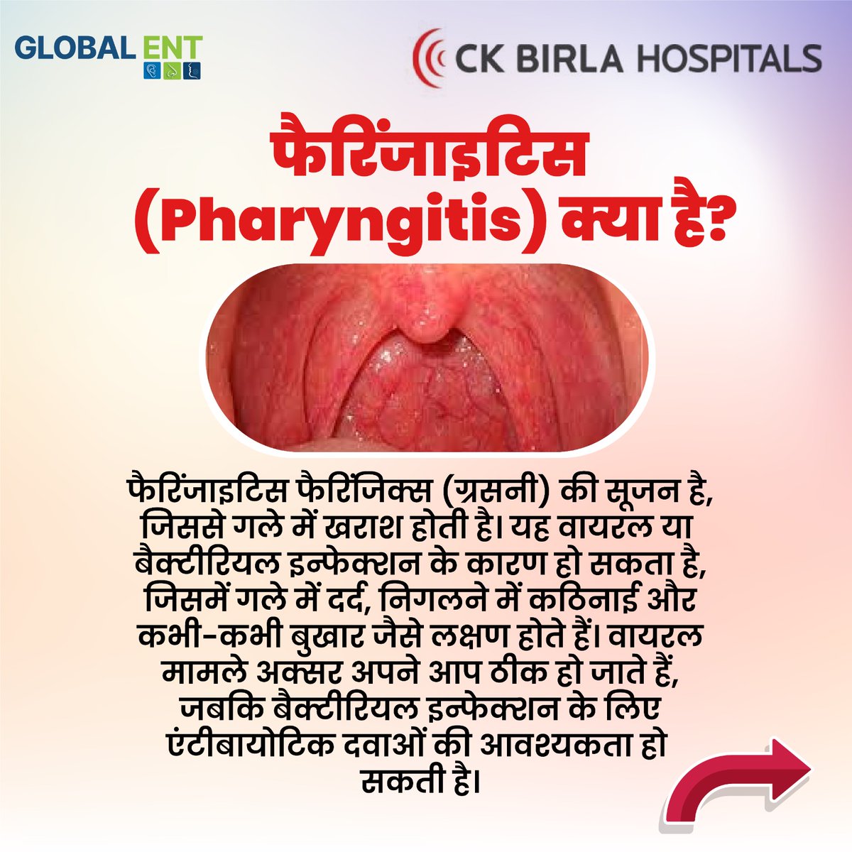 Globalentcare's tweet image. Understanding Pharyngitis: Learn about causes, symptoms and treatments for throat irritation and swelling. Embrace a healthy lifestyle to alleviate the issue.

#ENTspecialist #Pharyngitis #ThroatInfection #Healthcare #Symptoms #Treatment #Prevention #DoctorofJaipur