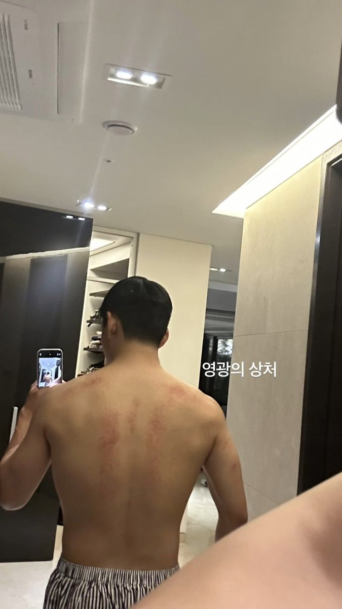 WEVERSE || V🌟 🔥 Wounds of glory