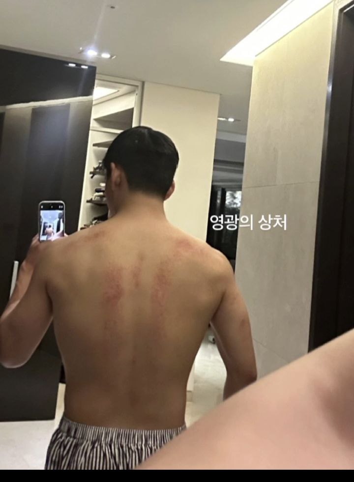 -star Taehyung abis kerokan😭

Pesona big boy badannya makin kekar😔🫂