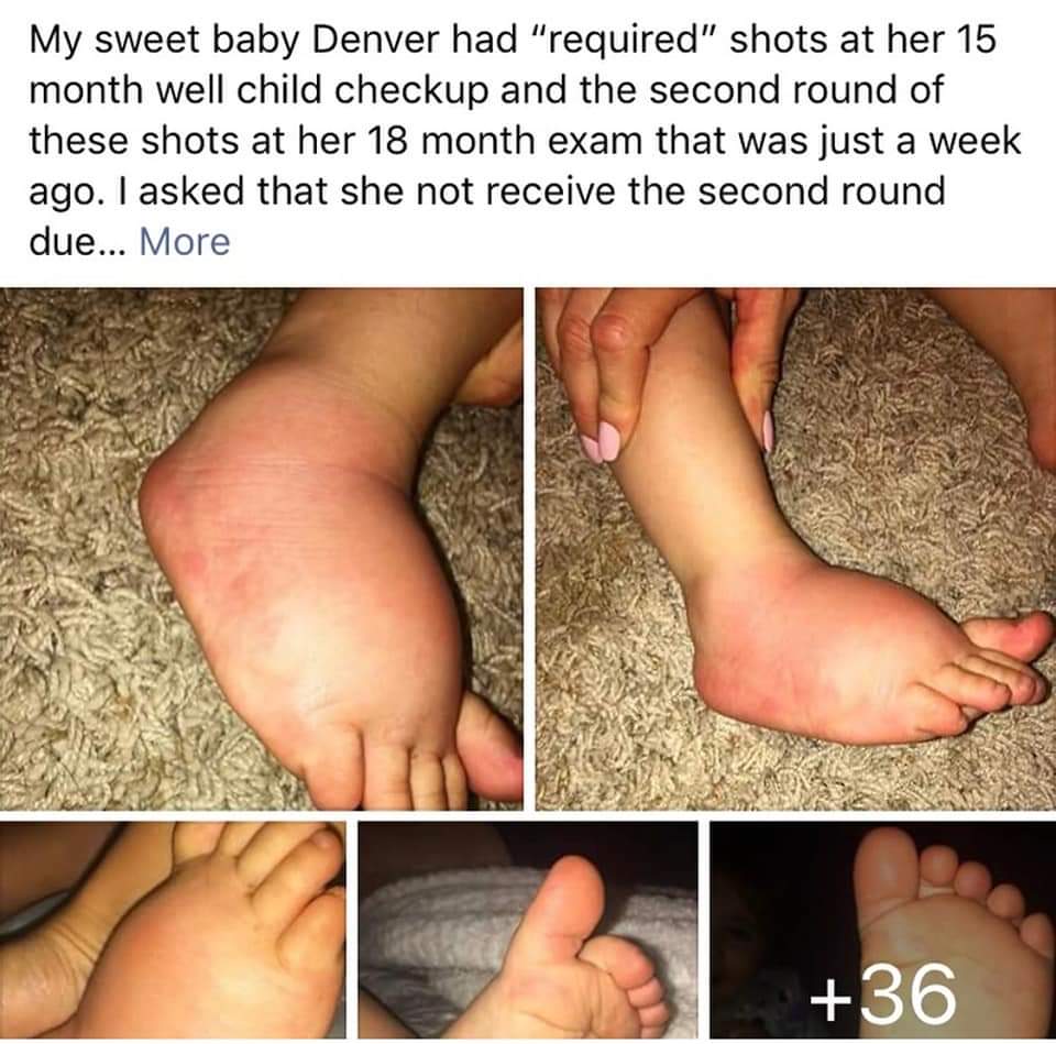 Shared by Mama- 'My sweet baby Denver had her 'required' shots at her 15 month well child checkup and her second round of these shots at her 18 month check up a week ago. I asked that she not receive the second round due to months of pain, fevers and inability to walk thanks to…