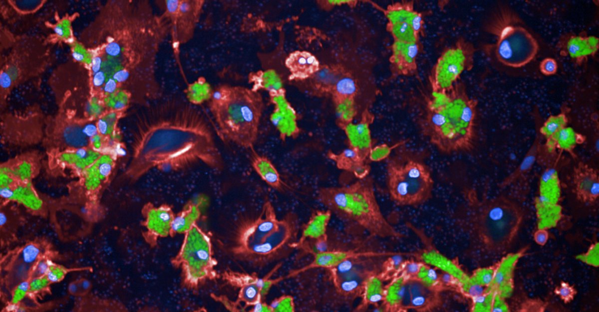 Are you facing quality issues when transporting #iPSCs or #iPSC-derived cells between locations? Here you can read three of our previous customers' #clinicalapplications and their solution. #cardiomyocytes #hepatocytes 
cellbox-solutions.com/applications