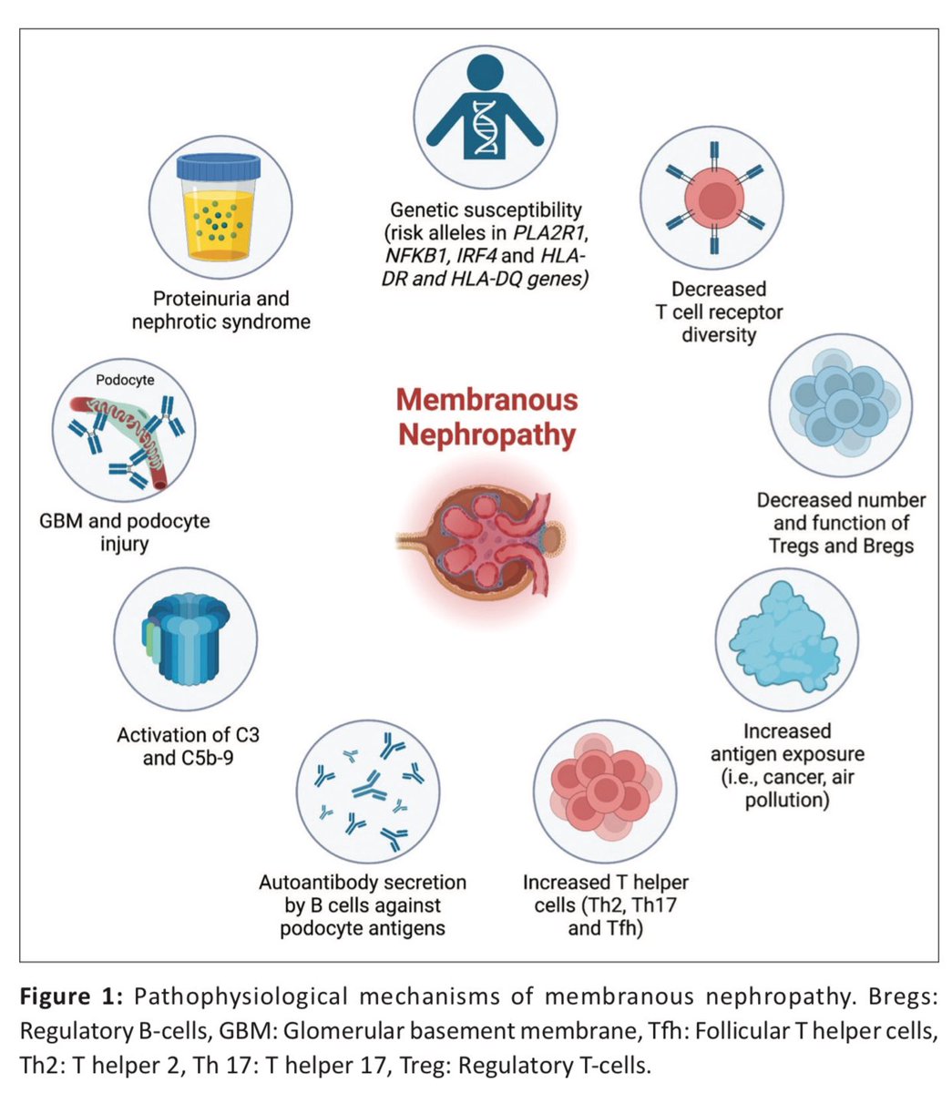 edgarvlermamd's tweet image. Updated Review of Membranous Nephropathy ca. 2024 from @indianjnephrol @OrhanEfe_ @nikkonephro @AnandhUrmila @NWiegley @GlomCon #Nephpearls

👉🏼 indianjnephrol.org/an-updated-rev…