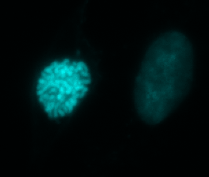 I don't work on mitosis so often anymore, but catching chromosome condensation like this on a regular old widefield will never ever get old to me