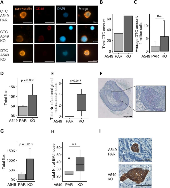 New study! HERC5 downregulation in #nonsmallcelllungcancer is associated with altered energy #metabolism and #metastasis For free👇 jeccr.biomedcentral.com/articles/10.11… #Mitochondria #Warburgeffect