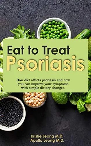 Diet plays a role in triggering #psoriasis flares. If you're struggling with this condition, make sure you're making the smartest dietary choices. #healthydiet #healthylifestyle buff.ly/4cHhKcS