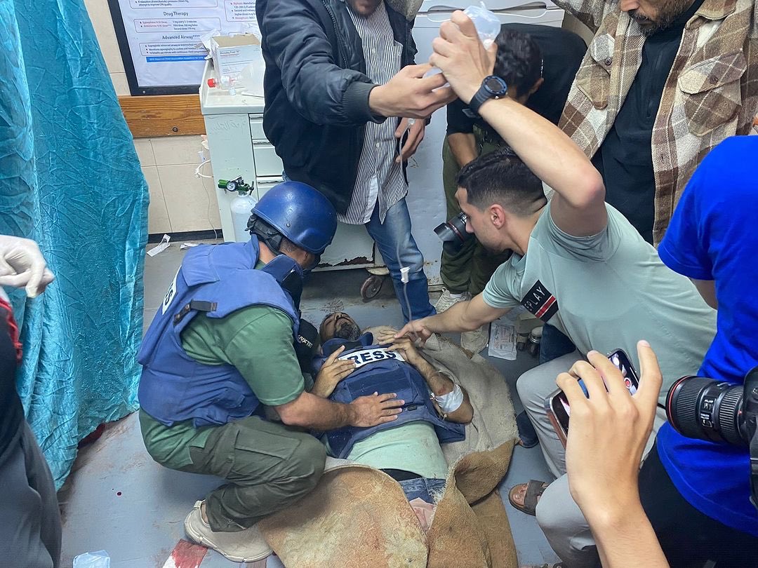 On the third day of Eid, the occupation is targeting journalists! In front of global cameras... Our colleague Sami Shhada had his foot amputated after targeted him while covering the news in Nuseirat camp!