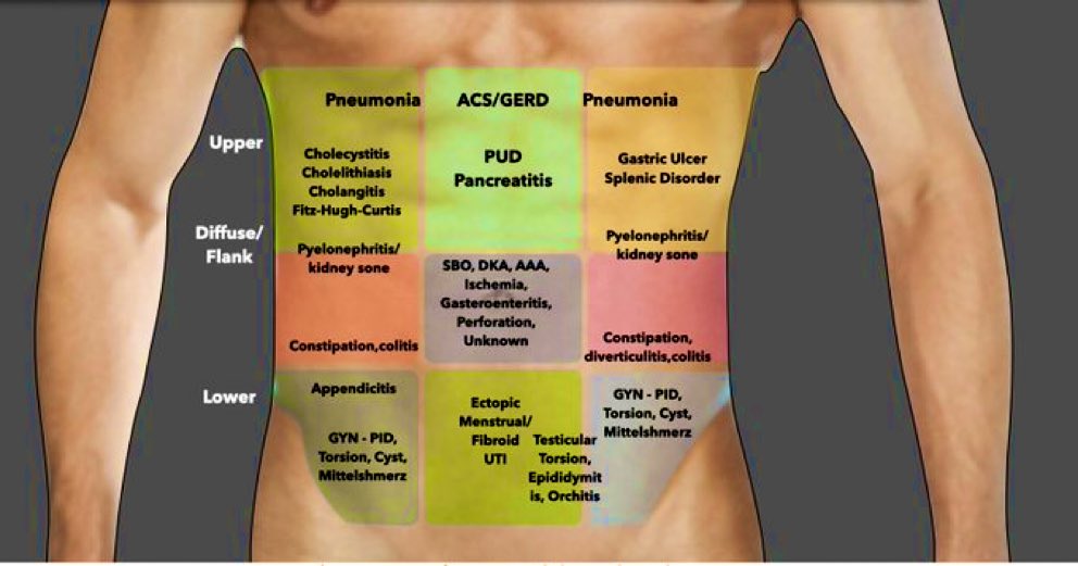 📌 Sources of abdominal pain #MedEd #FOAMed #FOAMcc