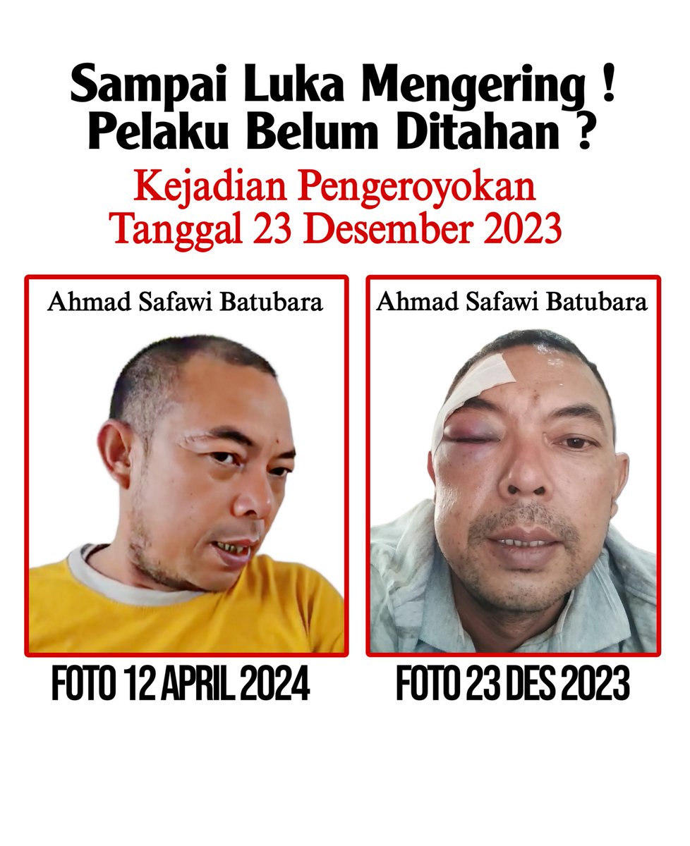 Sampai Luka Mengering & sembuh, Pelaku Pengeroyokan Belum Ditahan ?? Hebat Bener Pelakunya Pak @ListyoSigitP ? Cc @DivHumas_Polri @poldasumut_ @poldasumut @Trias232